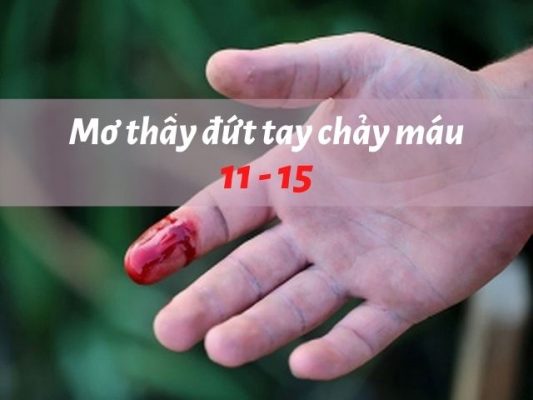 Mơ thấy đứt tay đánh đề con gì ?