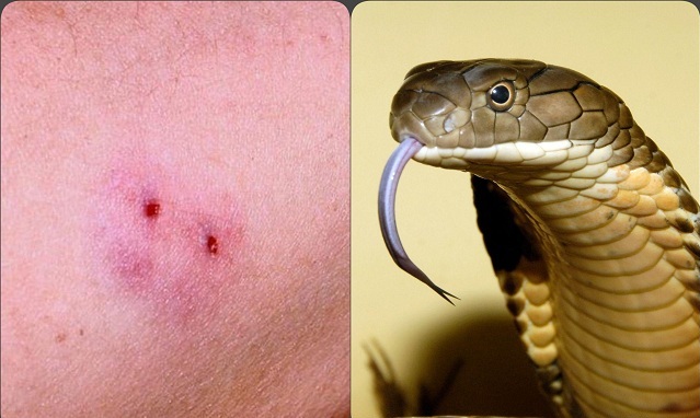 Thương tiếc đuổi theo một cơn ho