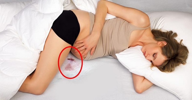 Mơ thấy kinh nguyệt