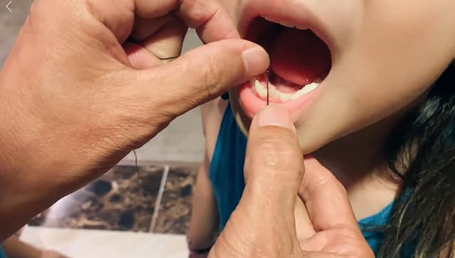 Đừng thay thế nho rang