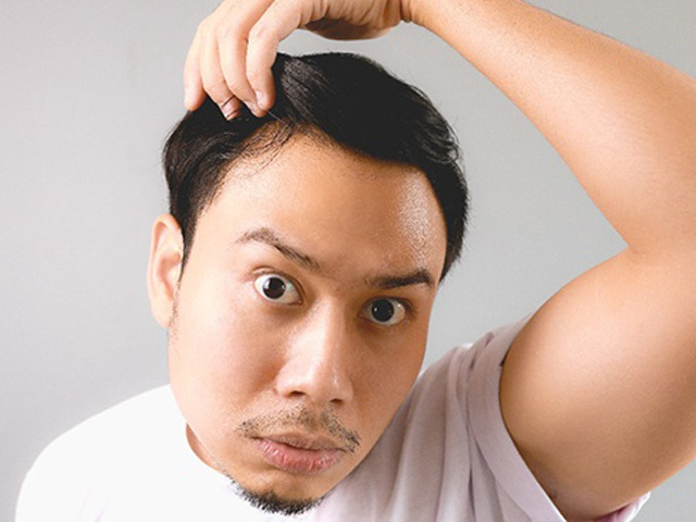 Một người đàn ông mơ thấy rụng tóc