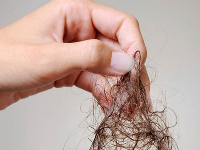Mơ thấy tóc rụng nhiều