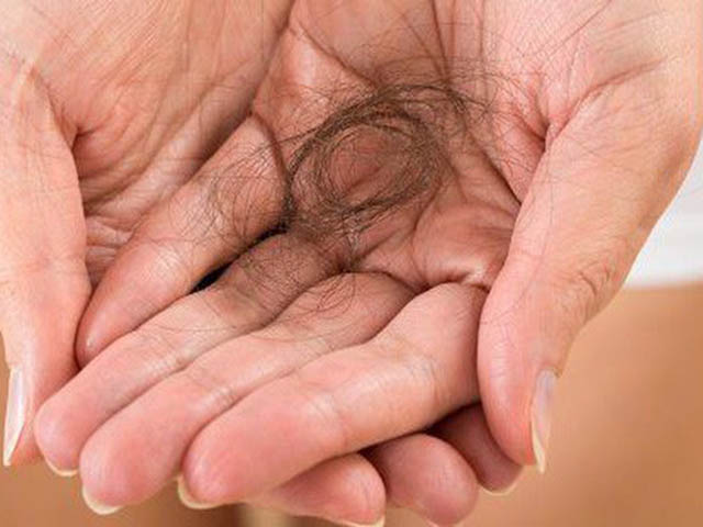 Nằm mơ thấy tóc rụng là điềm gì