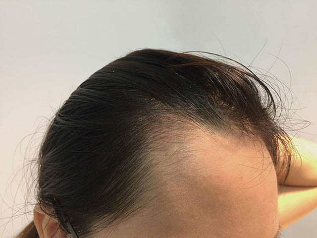 Giấc mơ có tóc mái