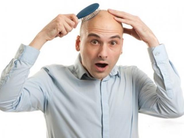 Nằm mơ thấy hói đầu và rụng tóc