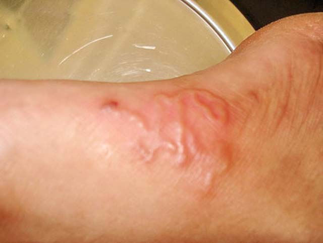 Đừng thay đổi con sâu